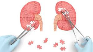 Illustration for article titled Obat Alami Batu Ginjal Pada Pria